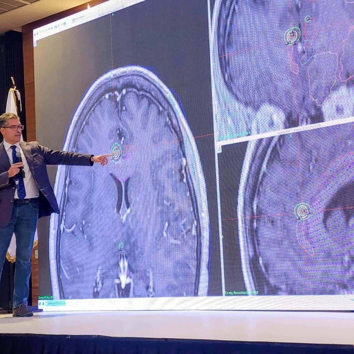Dr. Eduardo Lovo, neurocirujano y radiocirujano especialista en tumores cerebrales — 4